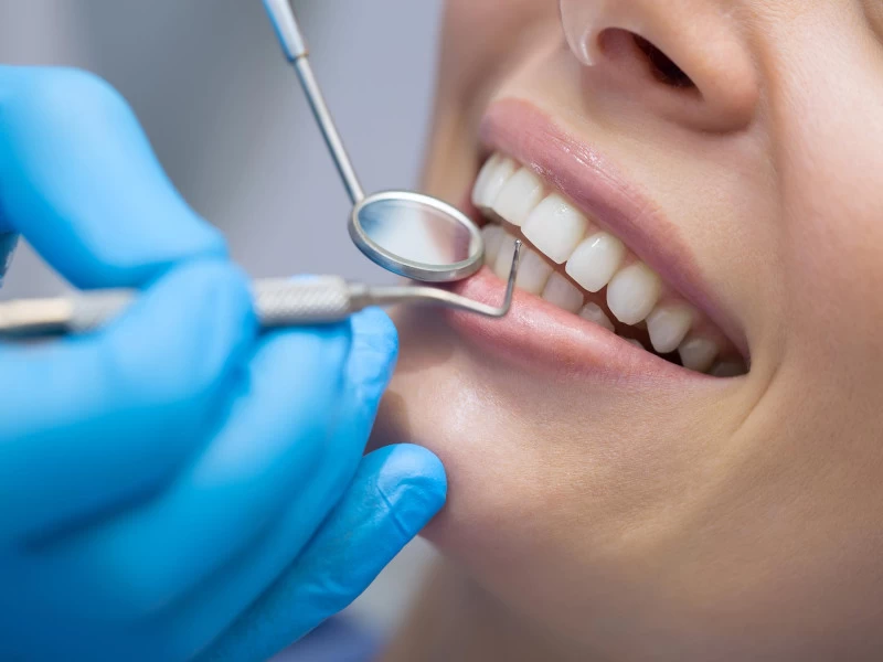 پر کردن دندان | انواع روش های پر کردن دندان